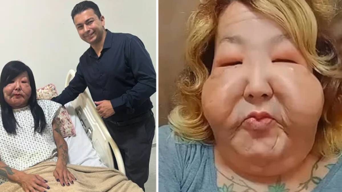 Estetik hayali kabusa dönüştü! Güzellik uğruna yüzü tanınmaz hale geldi